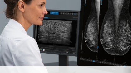 AFFIDEA: Τι σημαίνει η ταξινόμηση BIRADS στη μαστογραφία και γιατί είναι σημαντική